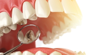 odontología general en Catarroja odontología general en Valencia