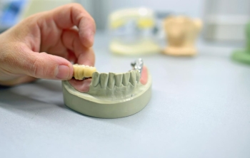 protesis-dentales-en-el-laboratorio-en-Catarroja protesis-dentales-en-el-laboratorio-en-Valencia