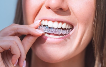 ortodoncia invisible catarroja  ortodoncia invisible